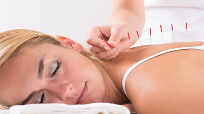 Exploring the Connection Between Chiropractic Care and Acupuncture: A Holistic Approach to Wellness