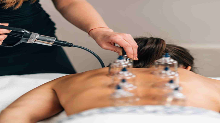 How Chiropractic Cupping Therapy Can Improve Your Overall Well-being